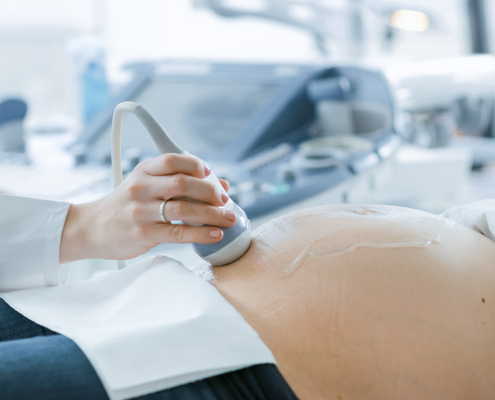 Ultrasound of a pregnant belly